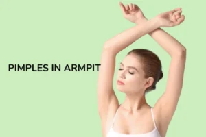 Pimples in armpit