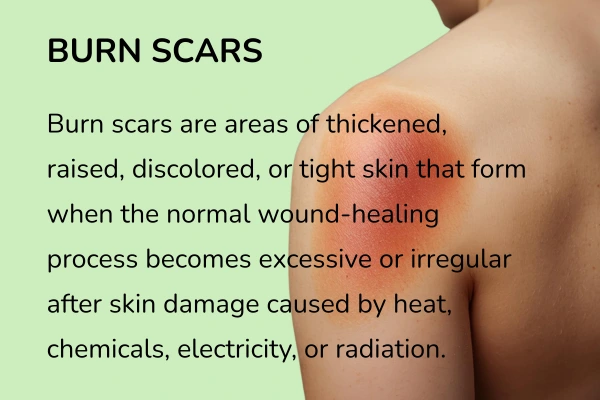 What is burn scars and how do they form?
