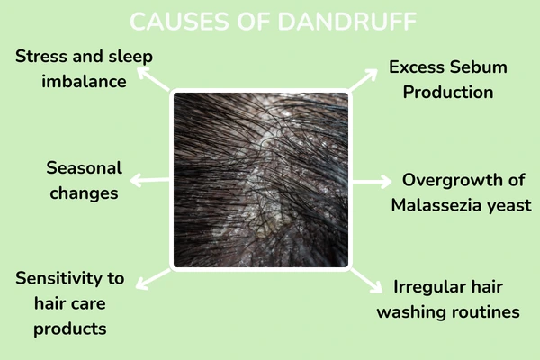 Causes of dandruff