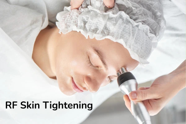 A women taking RF tightening