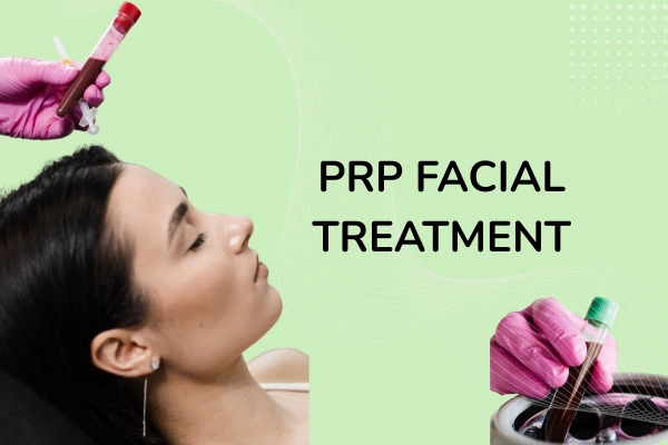 A women taking prp facial treatment