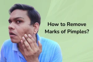 A men worrying about his marks on face