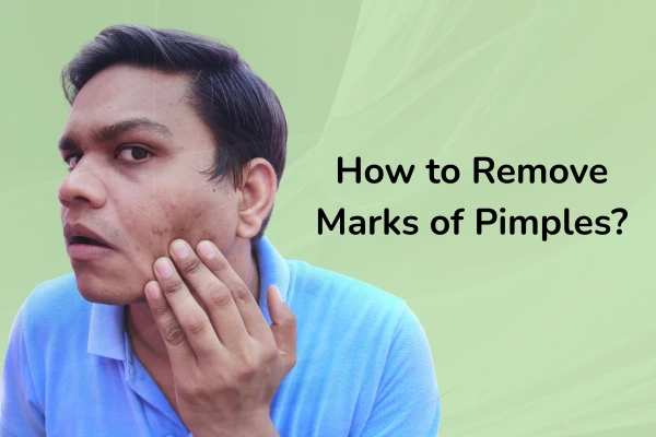 A men worrying about his marks on face