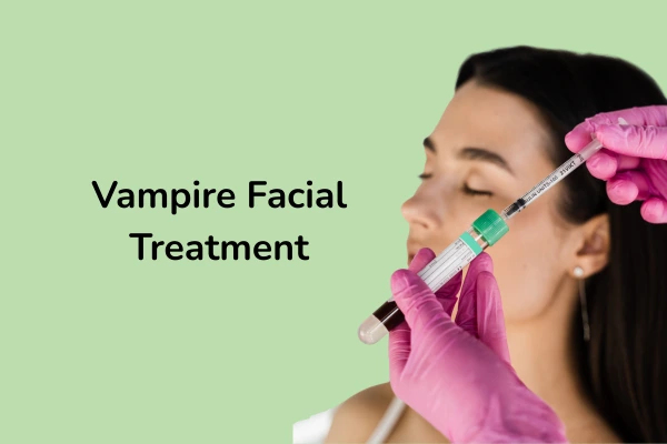 Vampire facial treatment or PRP for face