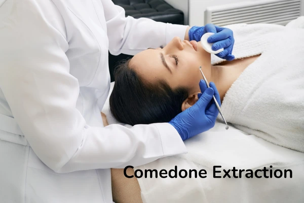 A women undergoing comedone extraction in clinical environment