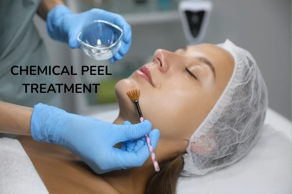 A women taking chemical peel treatment