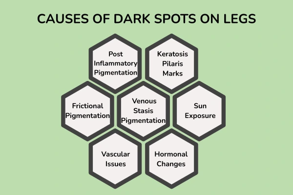 Causes of dark spots on legs