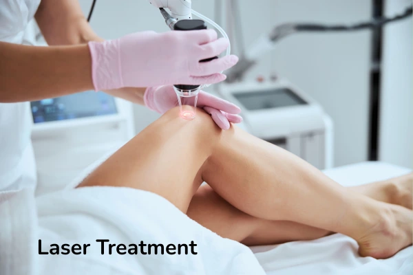 Laser treatment 