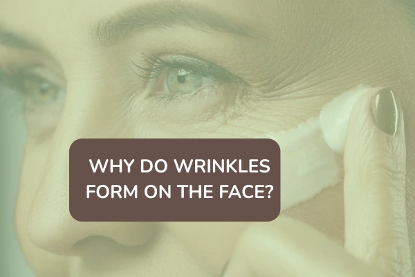why do wrinkles form on the face