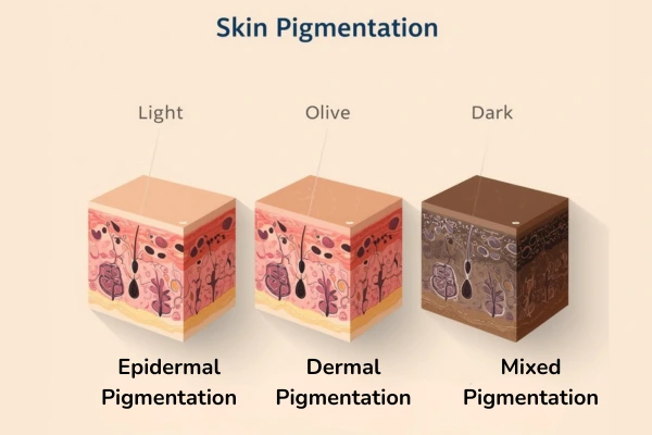 SKin pigmentation variants