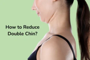 A women with double chin