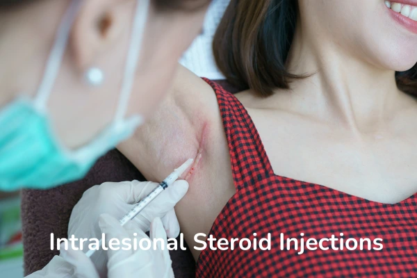 Steroids Injection Treatment