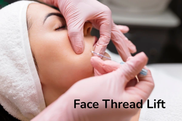 A women taking face thread lift treatment