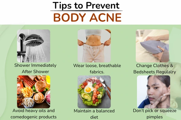Tips to prevent body acne