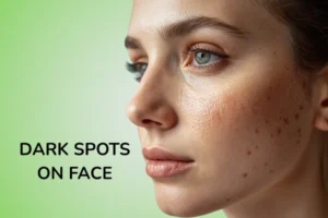 a WOME WITH DARK SPOTS ON FACE