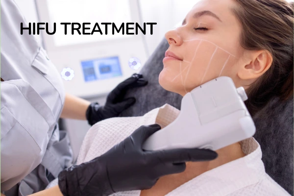 HIFU treatment