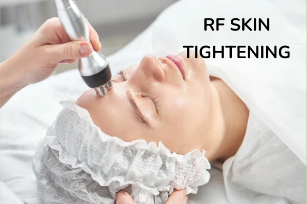 RF SKIN TIGHTENING