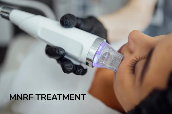MNRF treatment