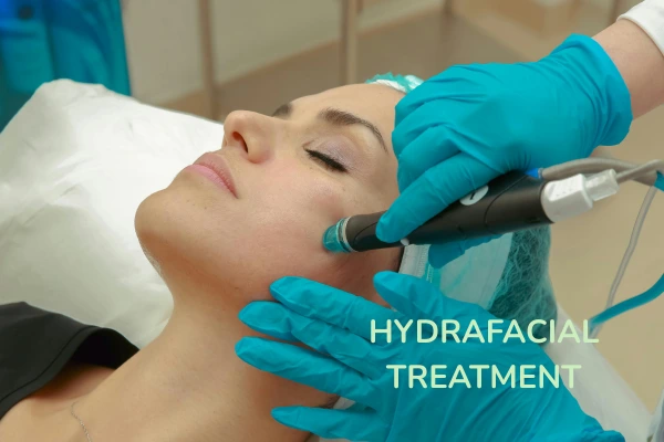 Hydrafacial treatment