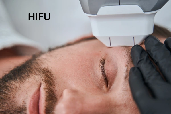 HIFU Treatment