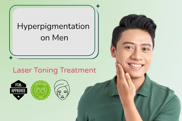 Hyperpigmentation in men