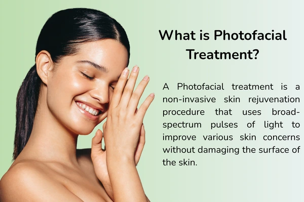 What is a photo facial treatment