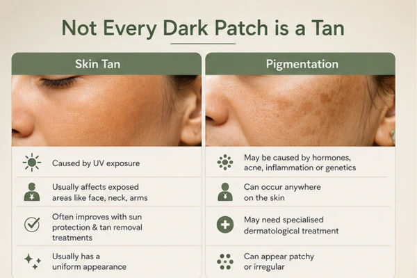 how to remove skin tan on face
