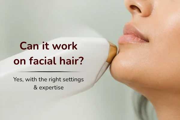 Does Laser Hair Reduction Work on Facial Hair?